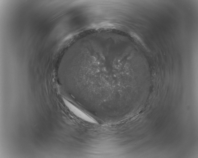 X0000061141063200512022241