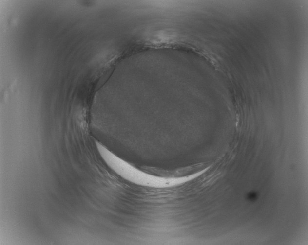 X0000061141156200512022240