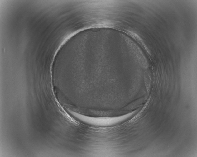 X0000061141184200512022239