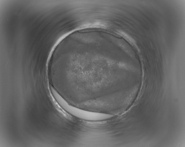 X0000061141200200512022239