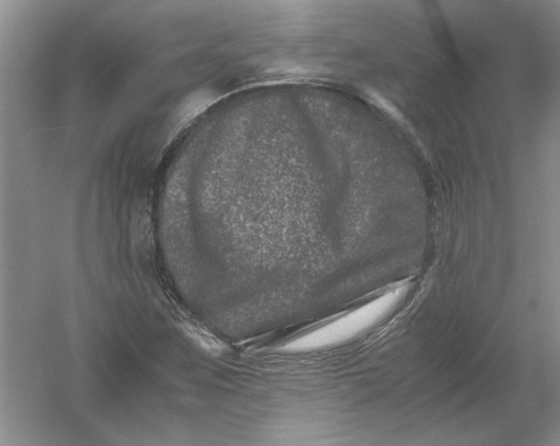 X0000061141259200512022238