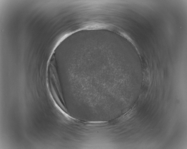 X0000061141487200512022234