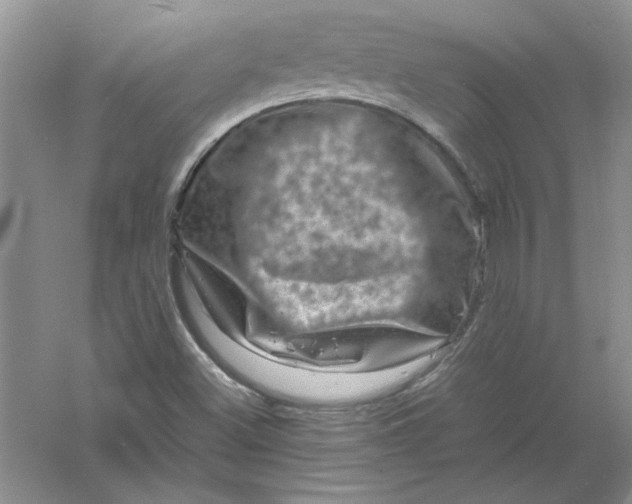 X0000061141500200512022233