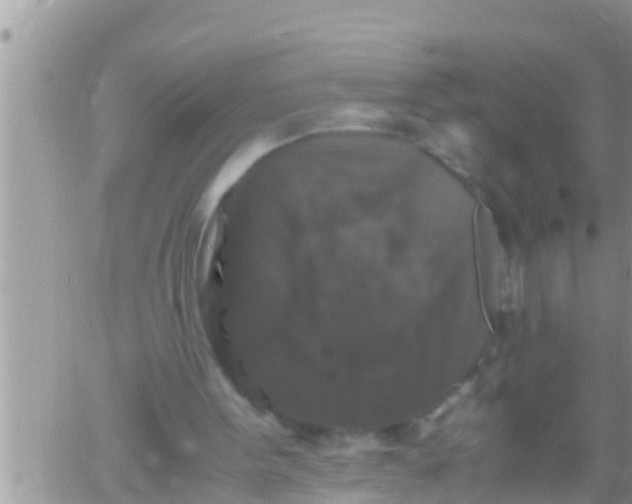 X0000061140099200512091944