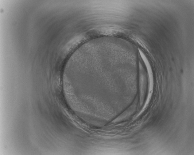 X0000061140407200512091939