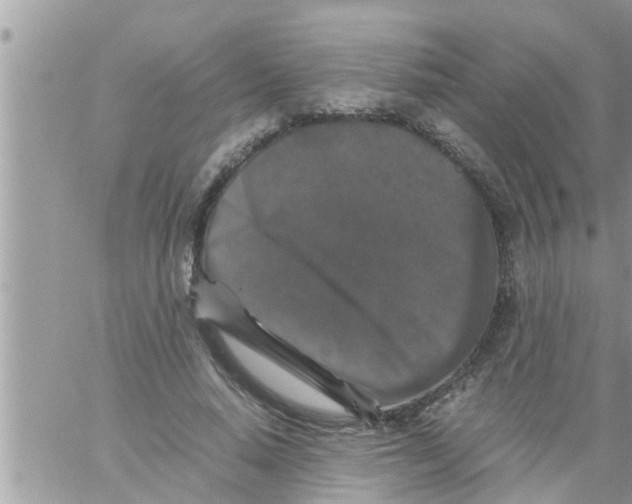 X0000061140640200512091935