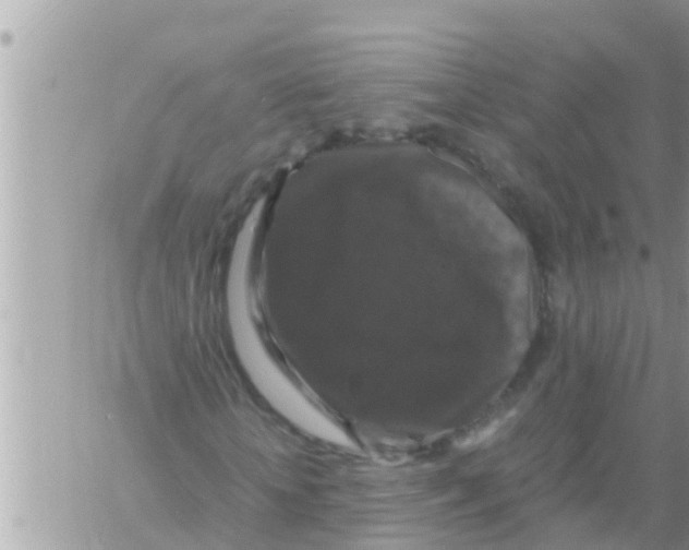 X0000061140818200512091931