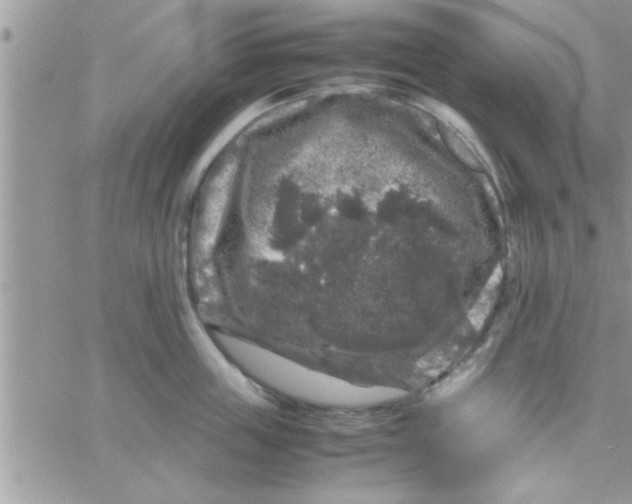 X0000061140859200512091932