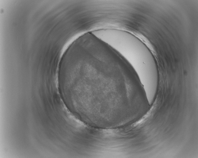 X0000061140904200512091931