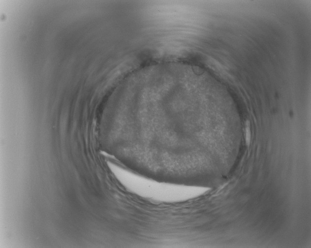 X0000061141059200512091928