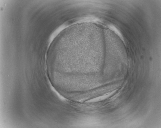 X0000061141103200512091927