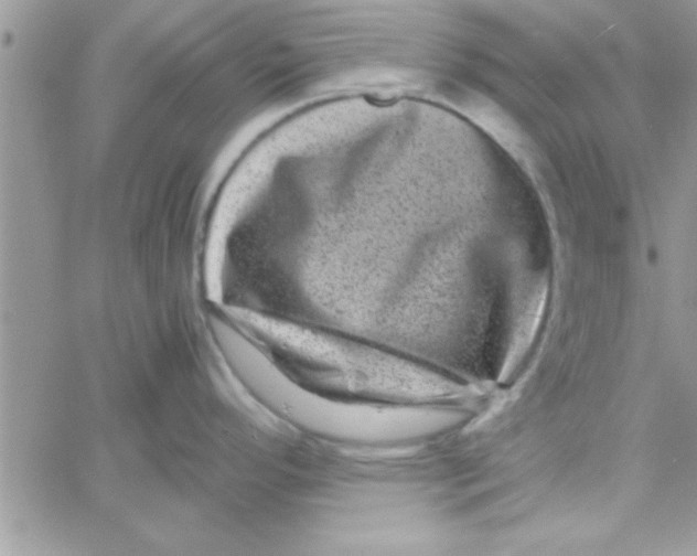 X0000061141296200512091924