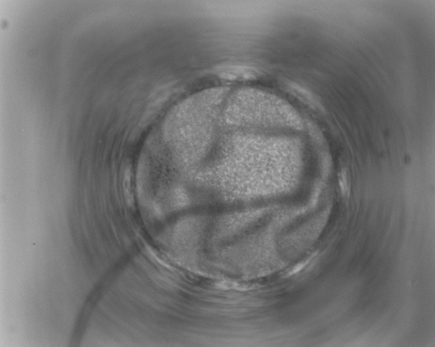 X0000061141396200512091922