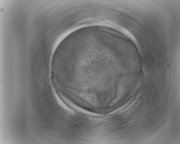 X0000061141528200512091921