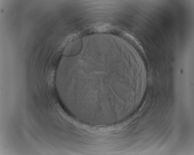 X0000061140018200512161541