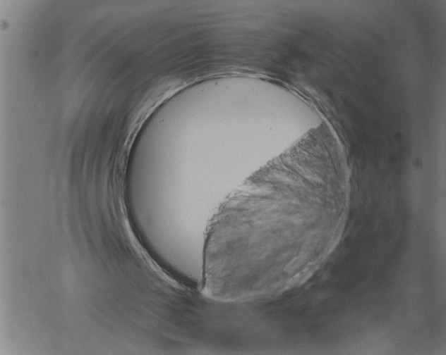 X0000061140049200512161540