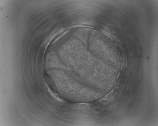 X0000061140050200512161540