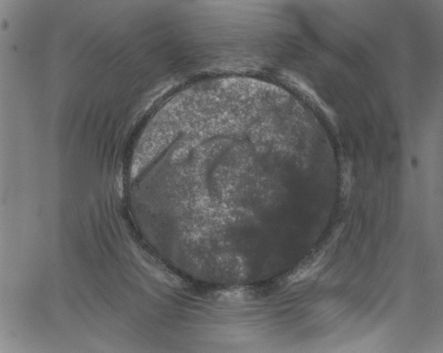 X0000061140068200512161540