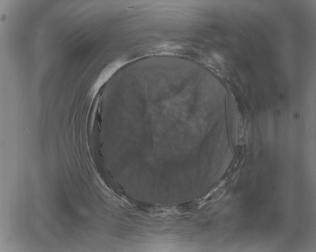 X0000061140099200512161540