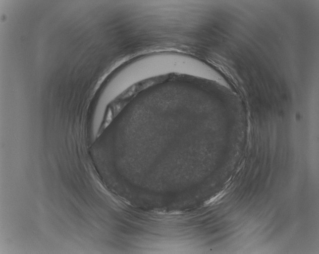 X0000061140156200512161539