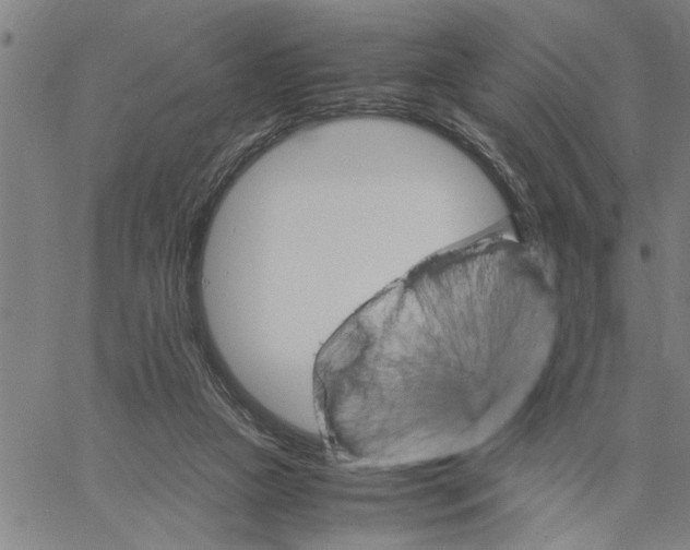 X0000061140161200512161539