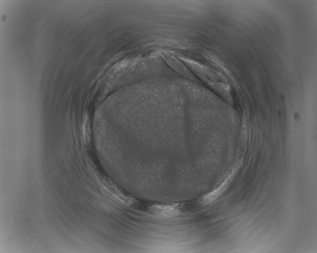 X0000061140170200512161539