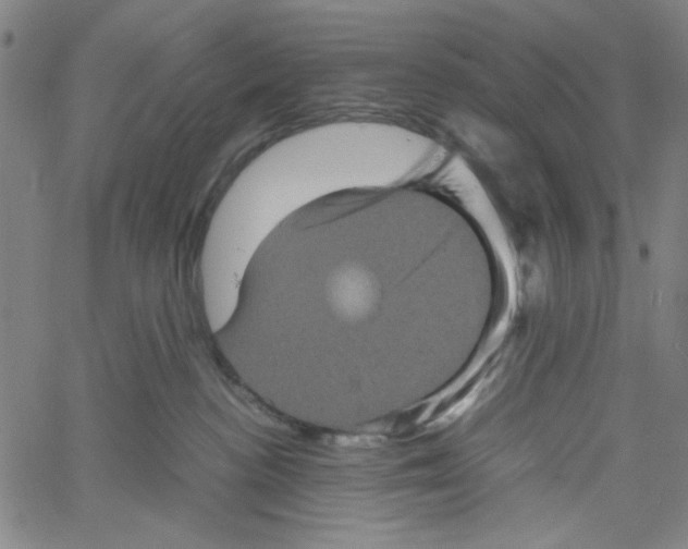 X0000061140188200512161539