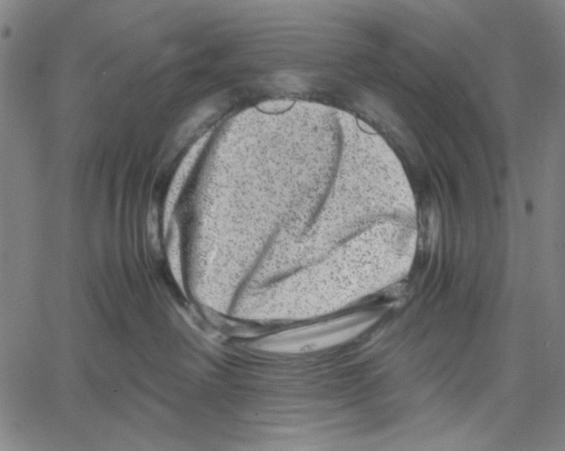 X0000061140238200512161538