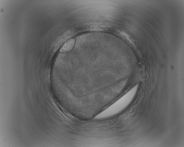 X0000061140299200512161537