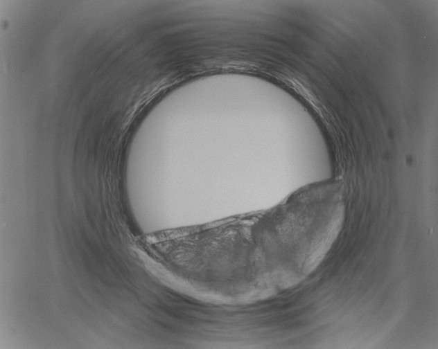 X0000061140357200512161536