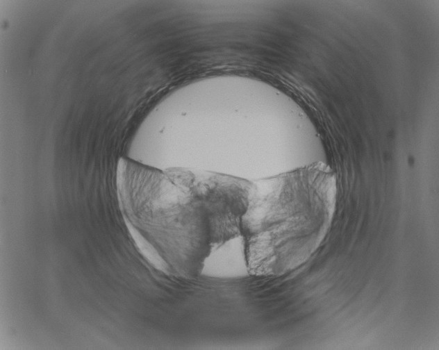 X0000061140369200512161536