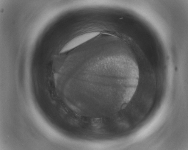 X0000061140382200512161536