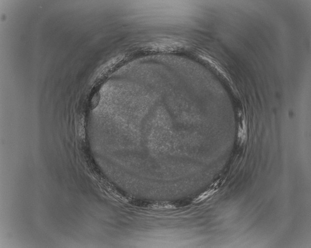 X0000061140403200512161535