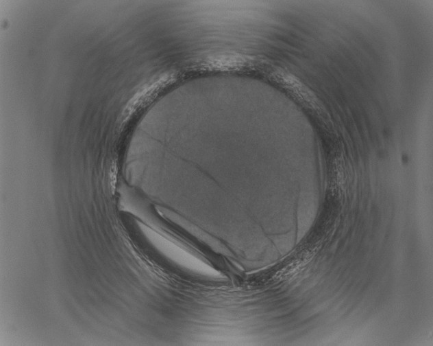 X0000061140640200512161531