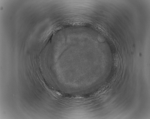 X0000061140695200512161530