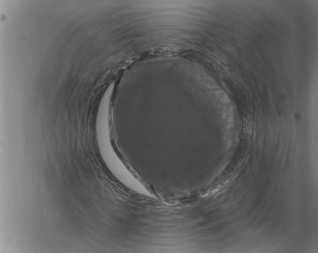 X0000061140818200512161528