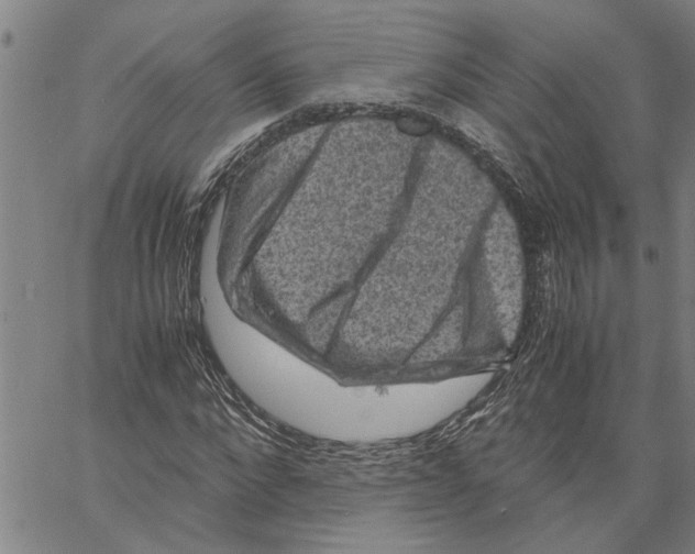 X0000061140872200512161527