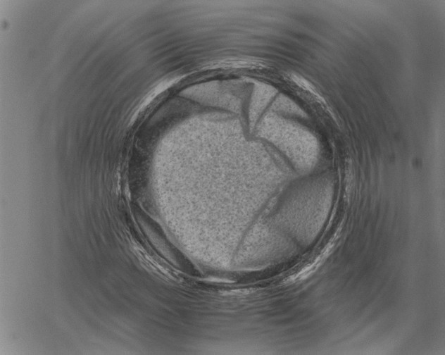 X0000061141017200512161525