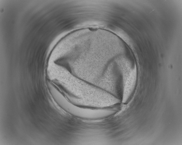 X0000061141296200512161520