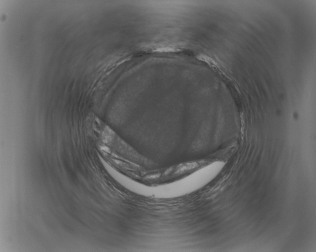 X0000061141300200512161520