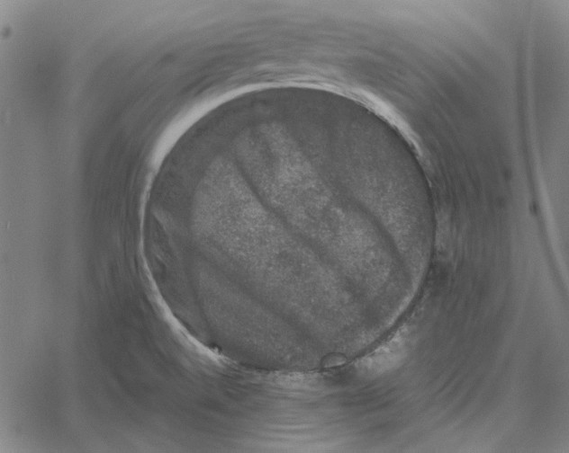 X0000061141520200512161517