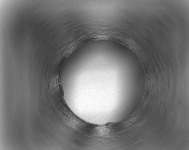 X0000061150425200511181038