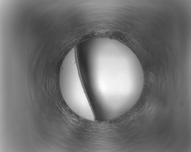X0000061150914200511181029