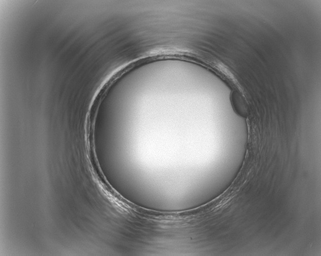 X0000061151124200511181026