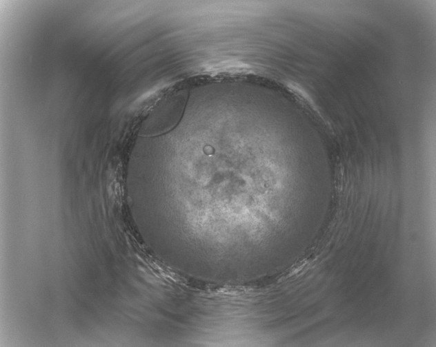 X0000061151063200511181228