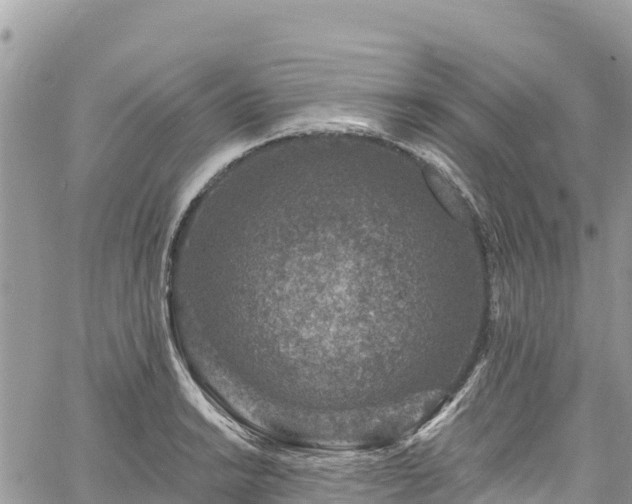 X0000061151038200511210956