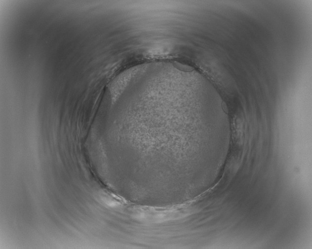 X0000061150033200512022326