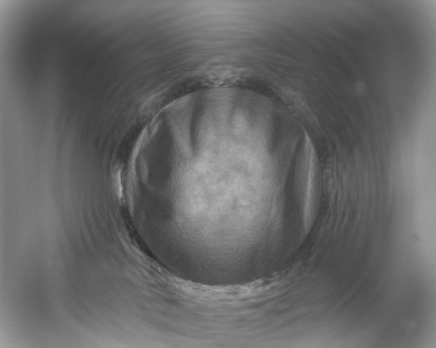 X0000061150042200512022326