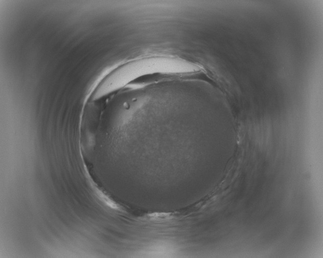 X0000061150052200512022325