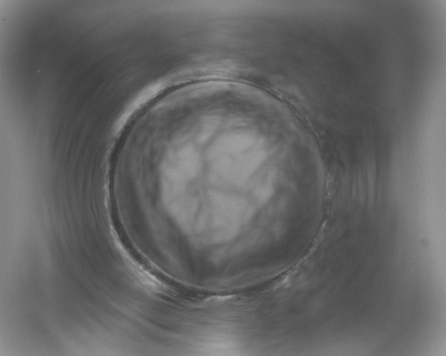 X0000061150054200512022325